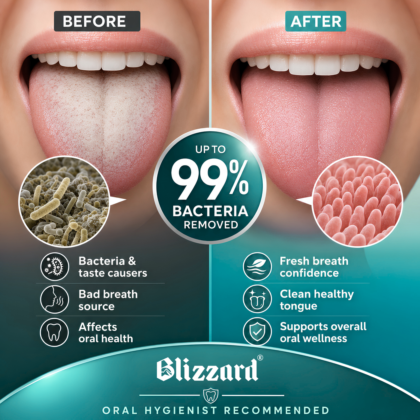 Fresher feeling between brushing