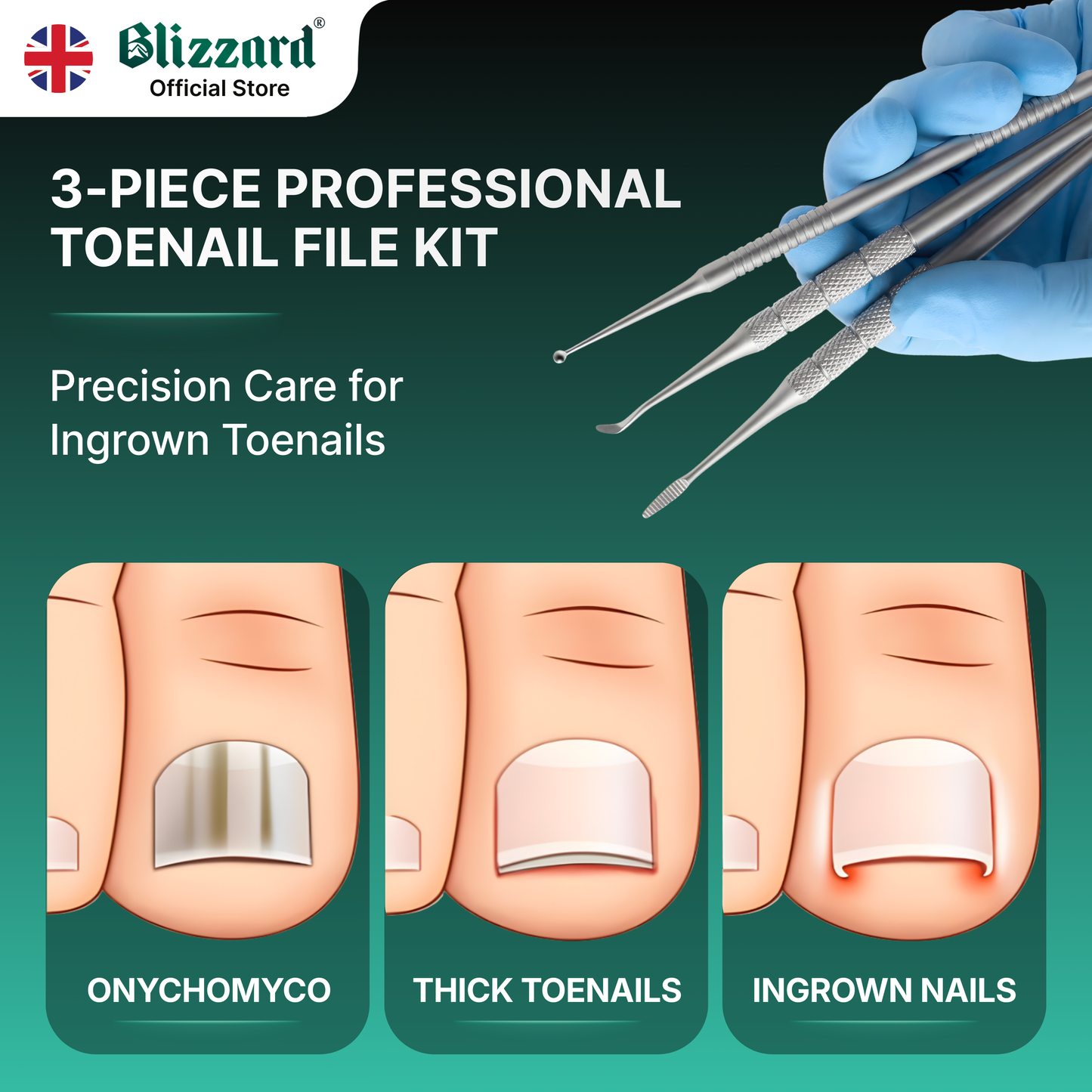 Blizzard Official Store 3-piece professional toenail file kit with tools and illustrations of nail conditions.