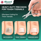 Advertisement for Blizzard nail clippers with text about toenail care on a green background.
