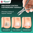 Blizzard nail clippers with a hand holding them, showing effectiveness on different types of toenails.