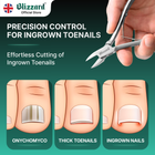 Advertisement for Blizzard nail clippers with a hand using the clippers and illustrations of toenail conditions.