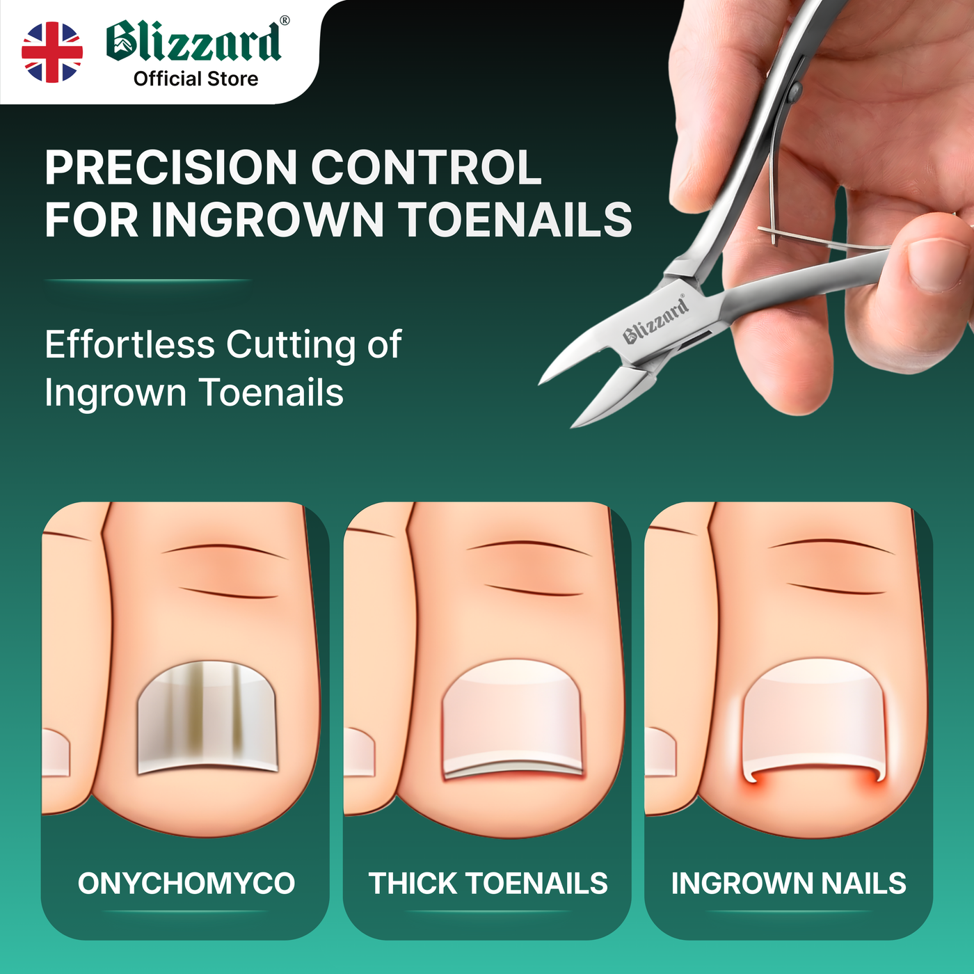 Advertisement for Blizzard nail clippers with a hand using the clippers and illustrations of toenail conditions.