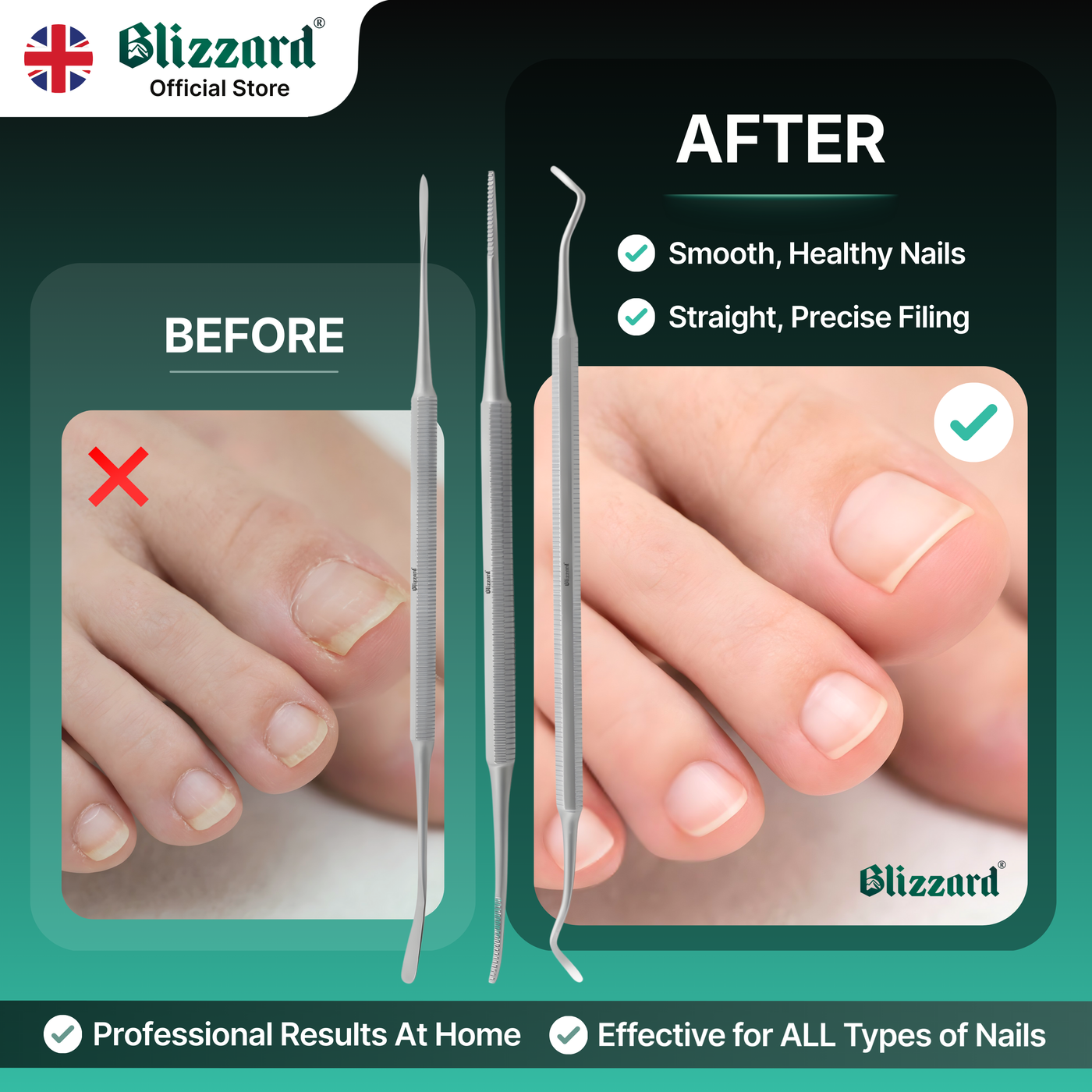 Before and after comparison of nail care using Blizzard tools with a green gradient background.