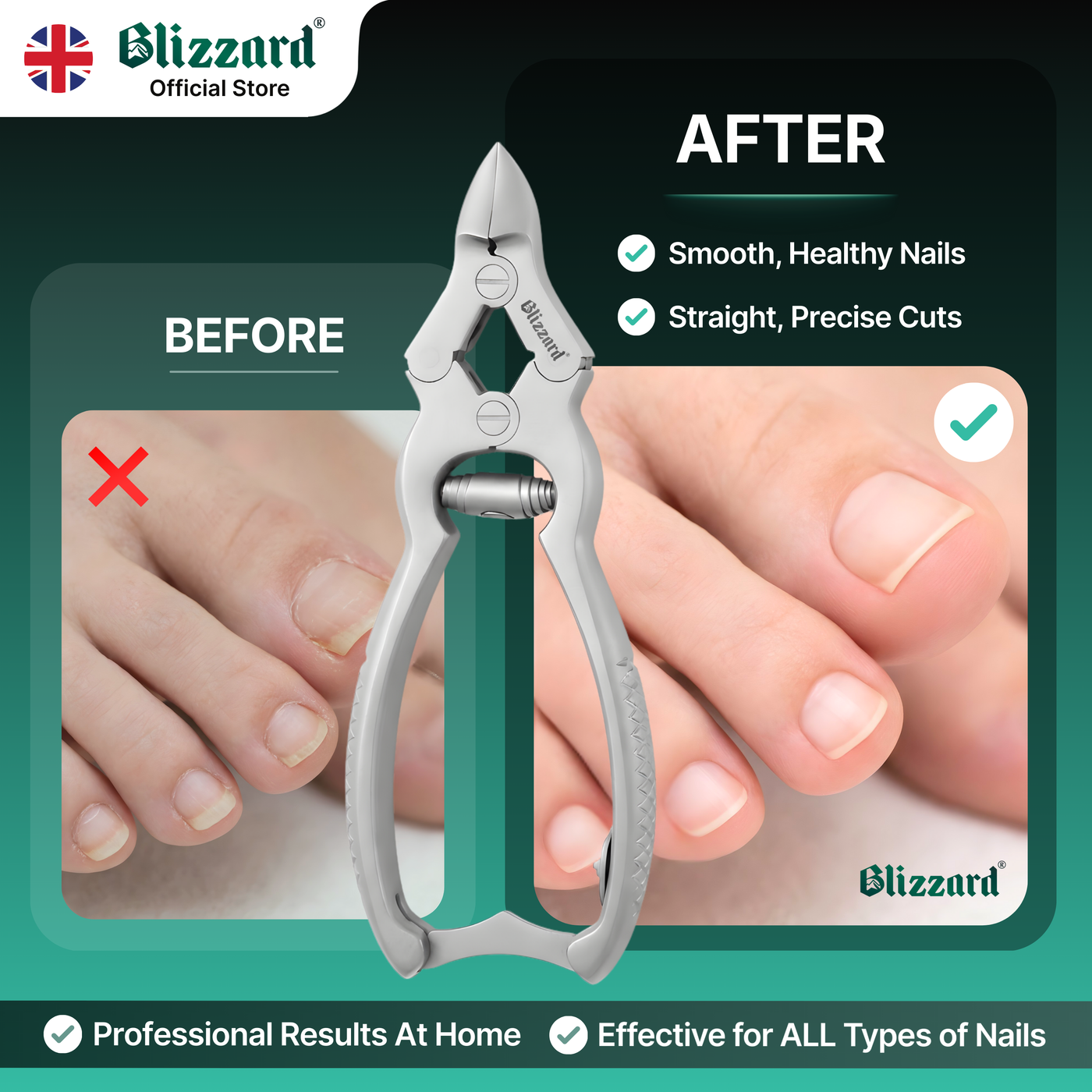 Blizzard nail clipper with 'Before' and 'After' comparison on a green background