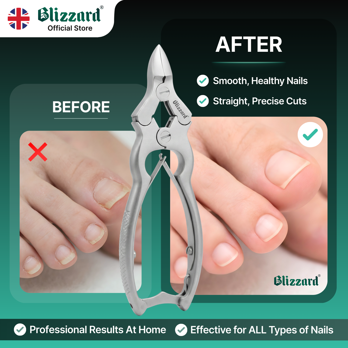 Nail clippers with 'Before' and 'After' comparison on a green background, featuring Blizzard branding.