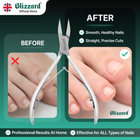 Blizzard nail clippers with 'Before' and 'After' comparison on a green background