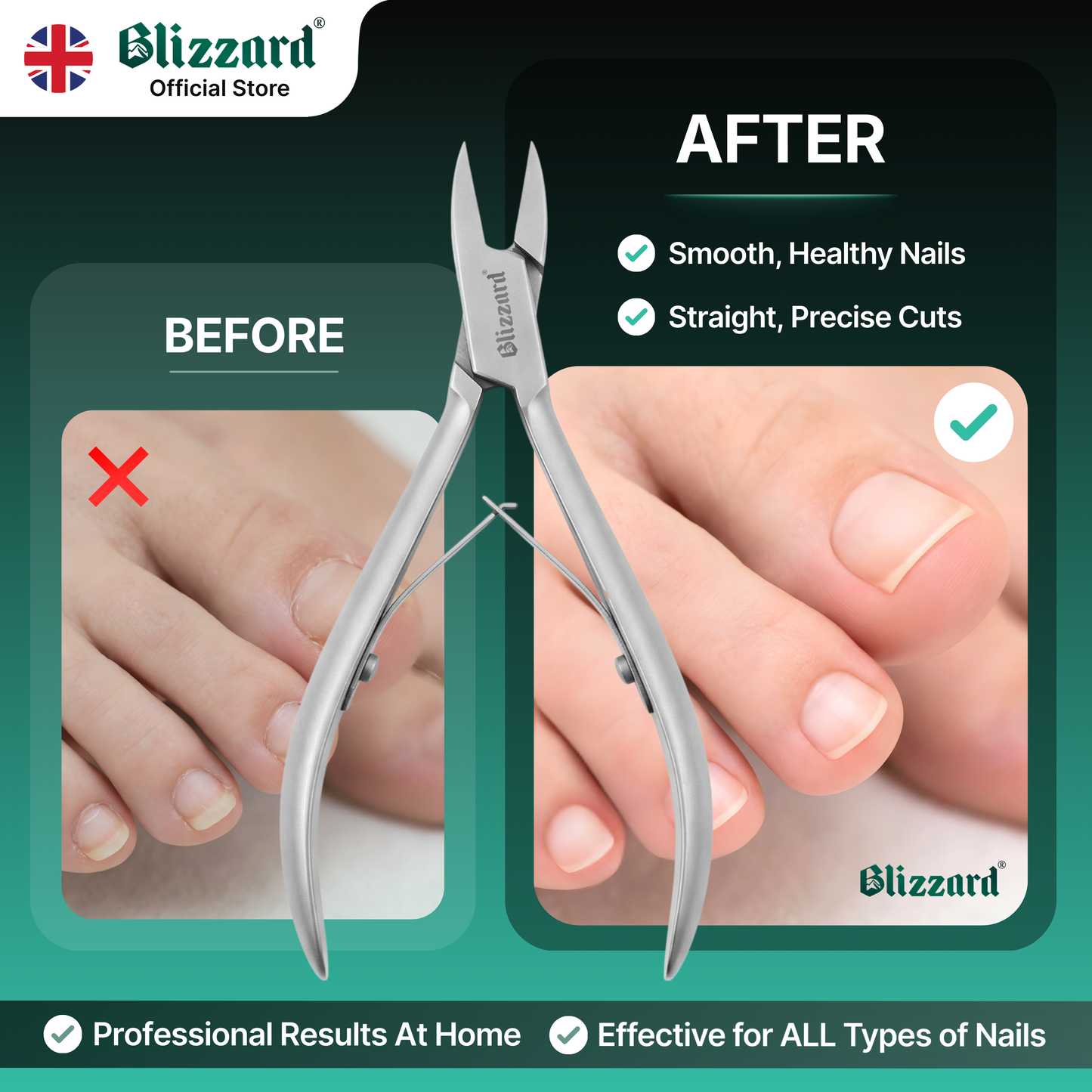 Blizzard nail clippers before and after use on nails with brand logo.