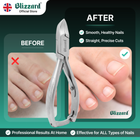 Blizzard nail clipper with 'Before' and 'After' comparison on a green background