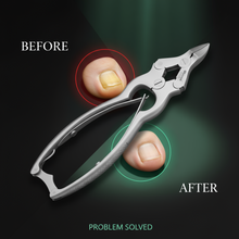 Load image into Gallery viewer, Blizzard® Heavy Duty Toenail Clippers | Nail Clippers for Thick Nails

